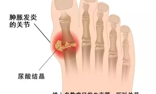 青蟹炖红酒能治抽筋吗-青蟹炖红酒的营养价值网-分享青蟹炖老酒功效，青蟹炖红酒的营养价值及功效知识库
